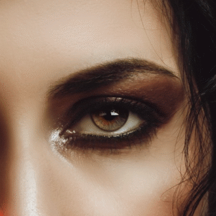 Bright Eyes, Naturally – Polynucleotide Treatment for Dark Circles