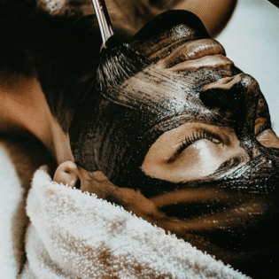 Carbon Laser Peel – The Ultimate Glow-Up