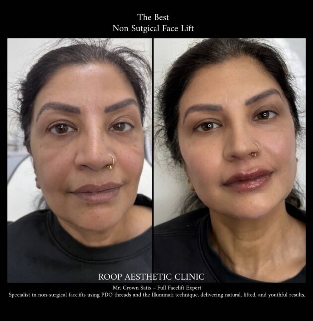 Full Face Transformation – Reveal Your Most Radiant Self